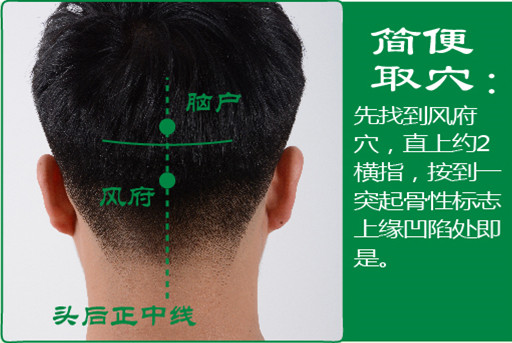 腦戶_2.jpg