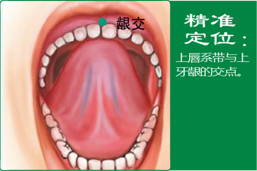 齦交_1.jpg